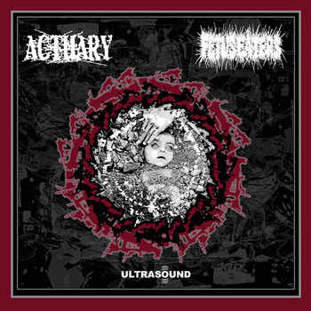 Fetus Eaters : Ultrasound